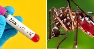 Zika virus