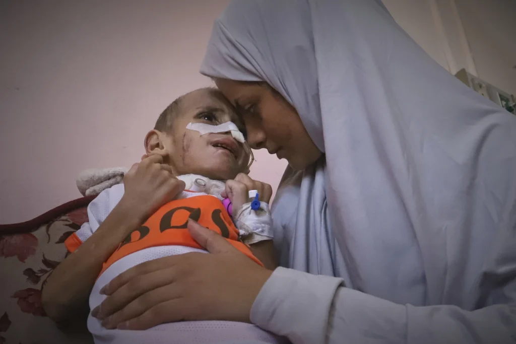 In war-torn Gaza, a toddler clings to life with brain injury