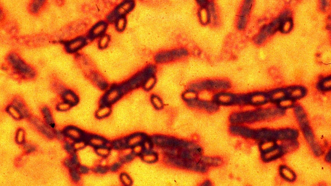 Govt takes urgent steps to fight anthrax