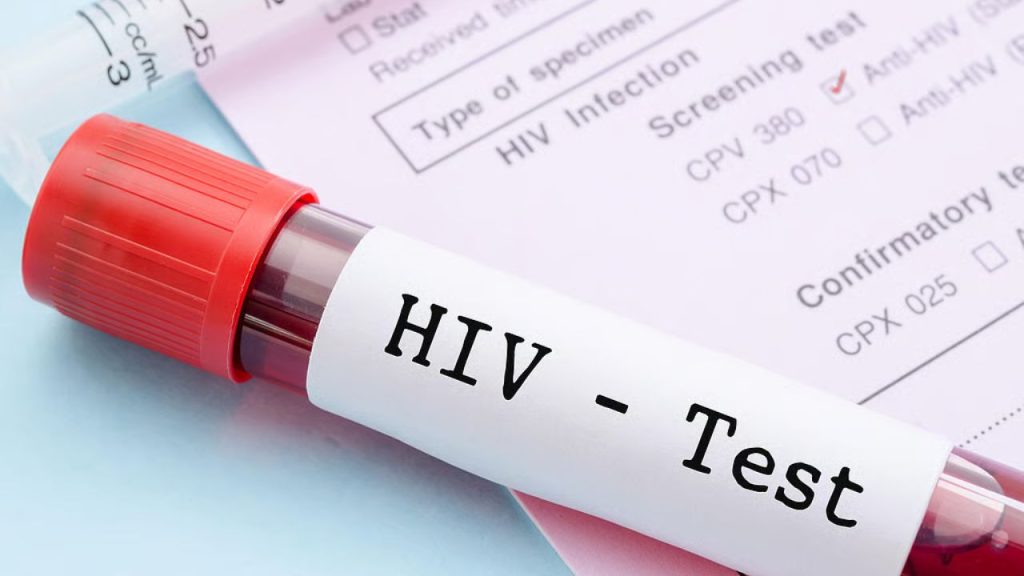 HIV Stigma