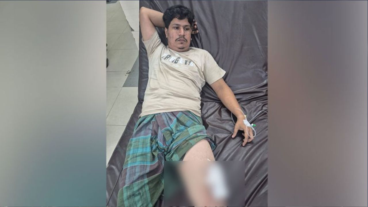 BNP activist, 4 others injured in Raozan gun violence
