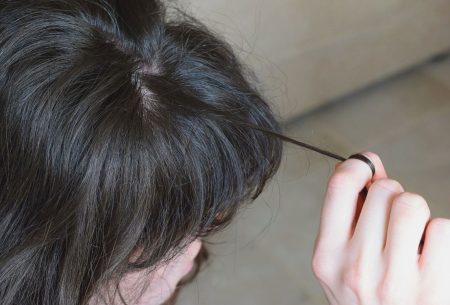 The silent struggle, Trichotillomania Trichotillomania