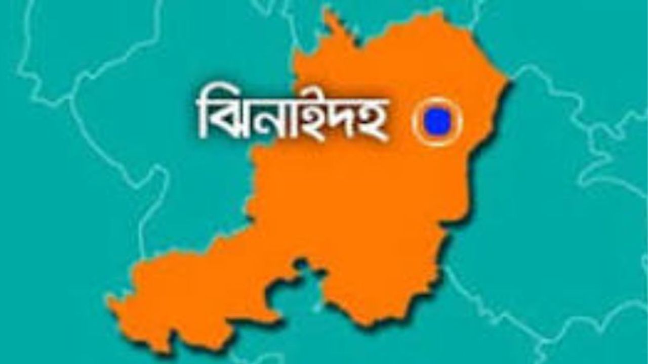 Woman ‘raped, burned’ by ex-husband in Jhenaidah