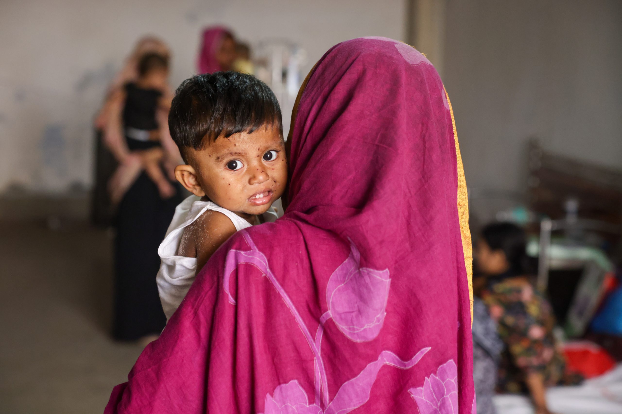 measles outbreak Bangladesh