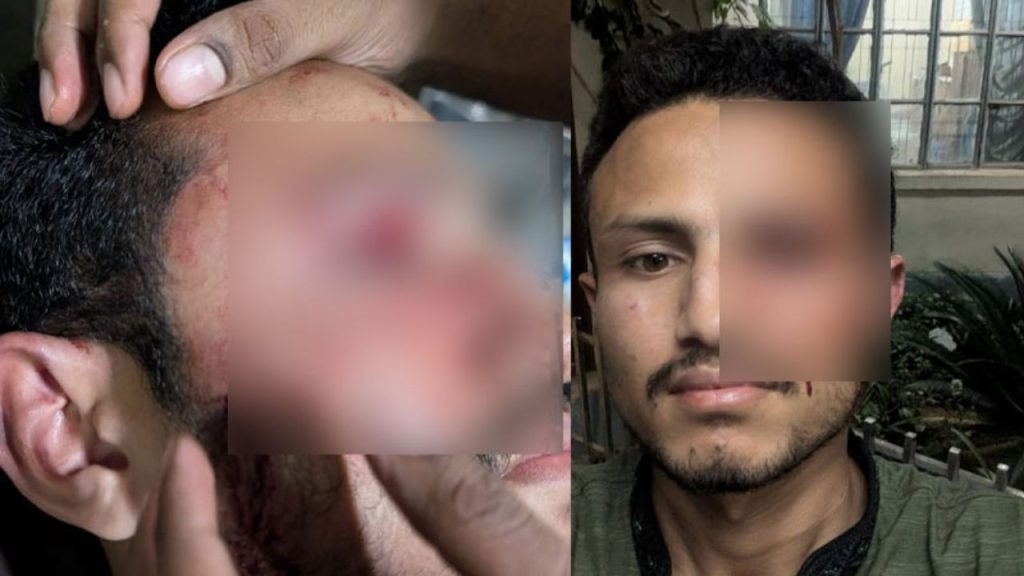 Cucsu leader attacked