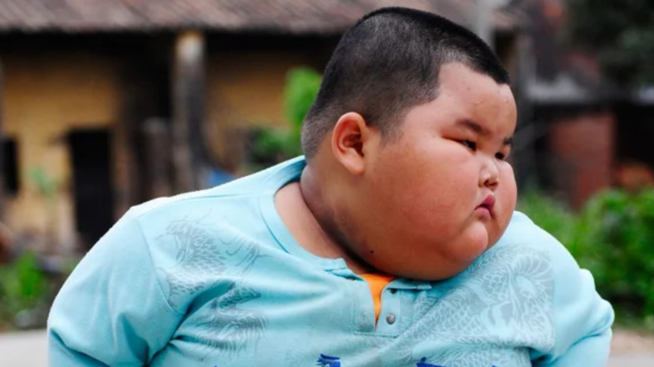 Italy faces childhood obesity epidemic obesity