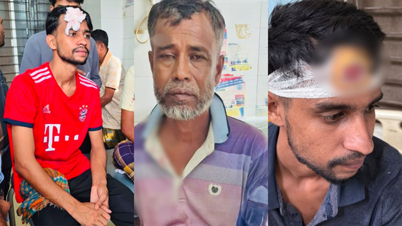 15 BNP men hurt in Sunamganj attack allegedly by AL activists Sunamganj attack