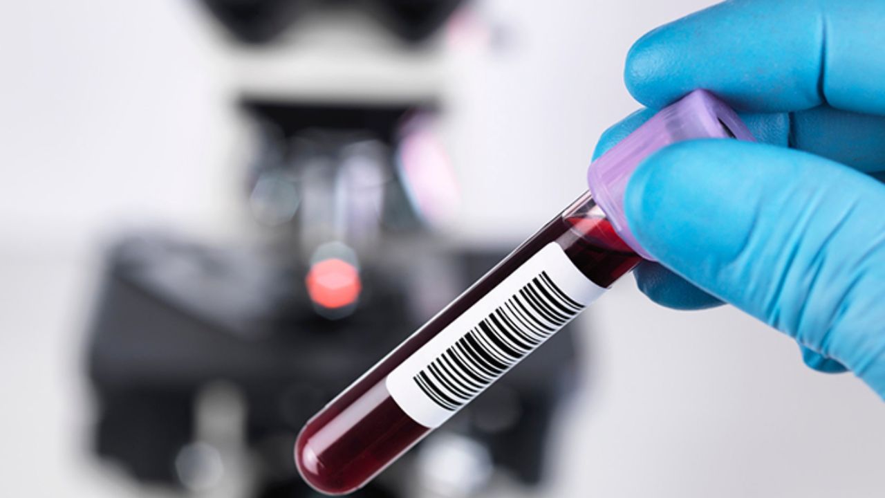 hepatitis c