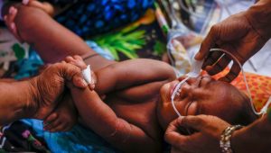 Sylhet faces highest measles death ratio